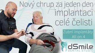 Revoluční implantace All-on-4 v #dsmile #implant #dentist #allon4dentalimplants