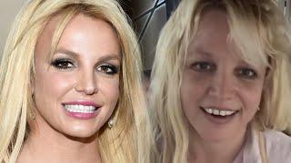 Is This What happened to Britney Spears' Teeth