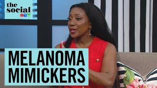 Must-know melanoma mimickers | The Social