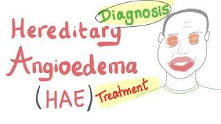 Hereditary Angioedema - Diagnosis and Treatment - Emergency Medicine