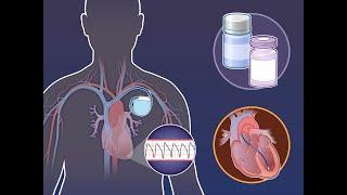 Catheter Ablation for Ventricular Tachycardia | NEJM