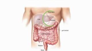 OClinic Gastric band and sleeve gastrectomy information seminar