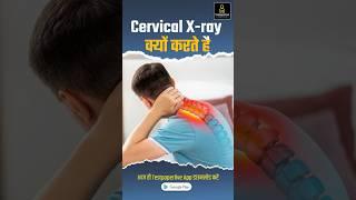Cervical X-ray | Cervical Spondylosis | Cervical Exercise #cervical #xraytechnician #testpaperlive