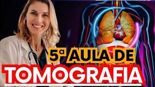 Desvendado anatomía aplicada a tomografia #radiologia