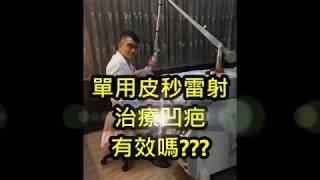 單用#皮秒雷射治療凹疤有效嗎?