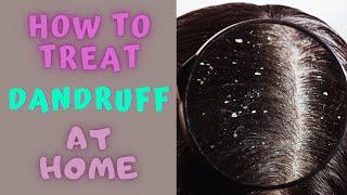 HOW TO TREAT DANDRUFF AT HOME - Dandruff Medical and Home Remedies.