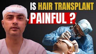 Is hair transplant painful ? know the real truth.