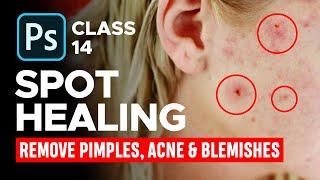 How to Use Spot Healing Brush to Remove Pimples, Acne and Blemishes in Photoshop - Urdu / Hindi