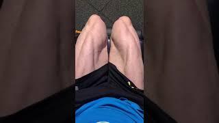 PT Guido. Quadriceps femoris. Beinstrecker