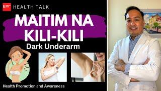 Maitim ang Kili-Kili (Dark Underarm): Causes, Risk factors and Treatment