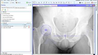 SmartHelp & Tips | Getting Started | Materialise OrthoView