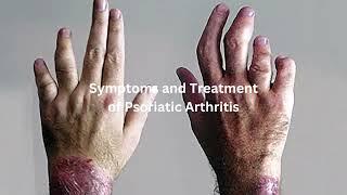 Symptoms and Treatment of Psoriatic Arthritis