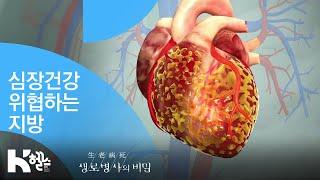 심장건강 위협하는 지방 - (20181121_671회 방송) 숨어있는 지방의 경고 이소성지방