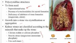 Ch 30 Urinary and Renal Disorders