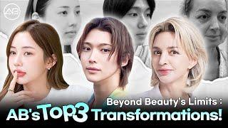 Top 3 Plastic Surgery Transformations You Won’t Believe! | AB Plastic Surgery Korea