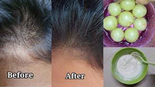Amla hair pack at home | hairfall control hair mask | hair regrowth hair pack | easy method hairpack