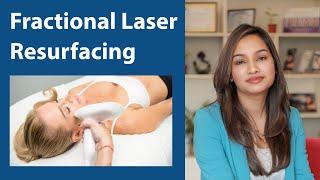 Laser Skin Resurfacing Treatment by Radio Frequency Method: Procedure Demonstration