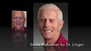 Cosmetic Dentistry Before and Afters