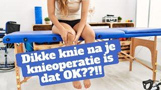 Dikke Knie na een Operatie: Alles Wat Je Moet Weten