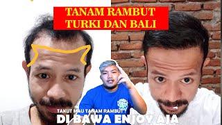 TANAM RAMBUT DI BALI | BEFORE AFTER ORANG SULAWESI !! 42 JT
