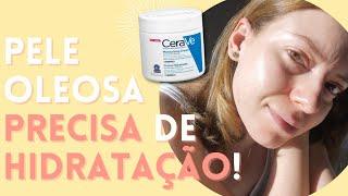 Creme Hidratante CERAVE: o passo final! | Produtos para Acne que FUNCIONAM! EP 05