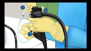 Colonoscopy: 1-2-3 Steps for Submucosal Injection - Graphic Illustration