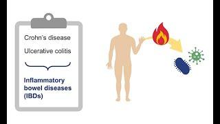 Reviewing inflammatory markers in joint pain and inflammatory arthropathies