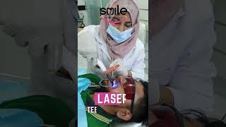 Laser Teeth Whitening | Smile By Alkhaleej