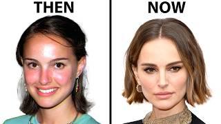 Natalie Portman's NEW FACE | Plastic Surgery Analysis