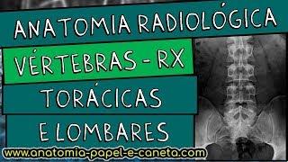 Anatomia radiológica (RX) da coluna vertebral - TORÁCICA E LOMBAR - Sinal do CÃO ESCOCÊS