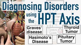 Diagnosing Disorders with HPT Axis - Pituitary and Thyroid Tumors, Graves’, Hashimoto’s, and Goiter