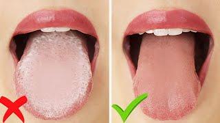 HOW TO: Get Rid of White Tongue & Bad Breath INSTANTLY!