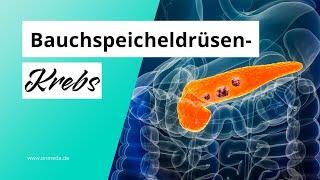 Bauchspeicheldrüsenkrebs: Diese Symptome können auftreten