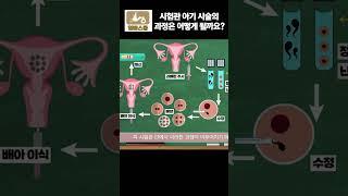 시험관 아기시술의 과정은 어떻게 될까요