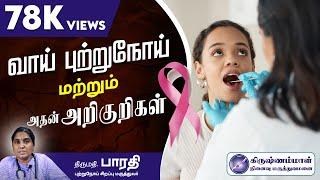 Oral cancer and its symptoms | வாய் புற்றுநோய் மற்றும் அதன் அறிகுறிகள்