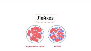 Острый и хронический лейкозы. Примеры анализов.