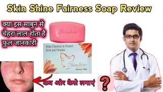 Skinshine Fairness Soap Review In Hindi | How To Use Skinshine Soap | कैसे यूज़ करे | Classy Indian