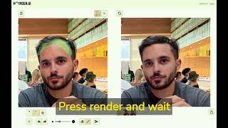 Ultra-realistic AI Hair Transplant Simulations