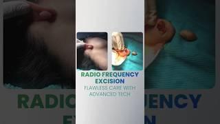 Keloid Removal Made Easy: Trust the Experts at | Institute  Cosmetique