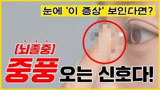 눈에 '이 증상' 보인다면? 중풍이 오고 있다는 신호입니다! 지금 당장 병원가세요!ㅣ중풍초기증상ㅣ중풍후유증ㅣ눈중풍