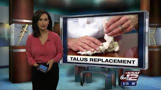 VIDEO: Talus Replacement Saves Feet