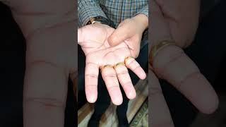 Single acupressure point for chronic kidney & urine problem @ayaancreatives