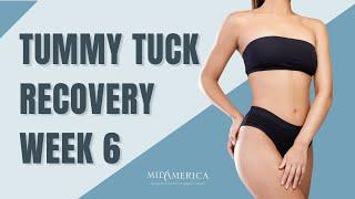 Tummy Tuck Recovery   6 Week Post Op