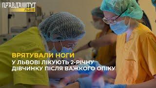 Врятували ноги дитини від ампутації