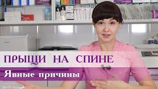 Прыщи на спине.  Явные причины.