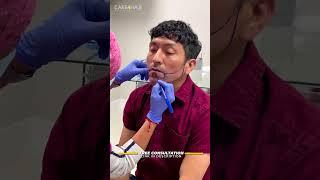 Beard Transplant: This is the procedure  | Care4Hair