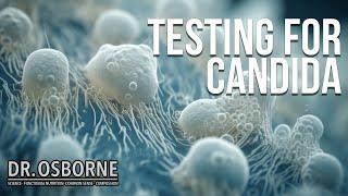 How To Test For Candida