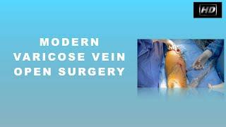 Trendelenburg Operation , Stripping and Hook phlebectomy for Lower Limb Varicose vein