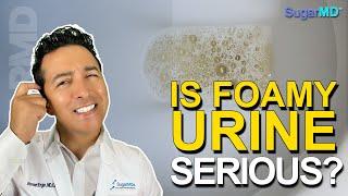 Top 5 Reasons Of Foamy or Bubbly Urine: One Is Kidney Disease!