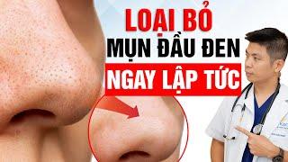 Loại Bỏ Mụn Đầu Đen Ngay Lập Tức Bằng Điều Chỉnh Chế Độ Ăn | Dr Ngọc